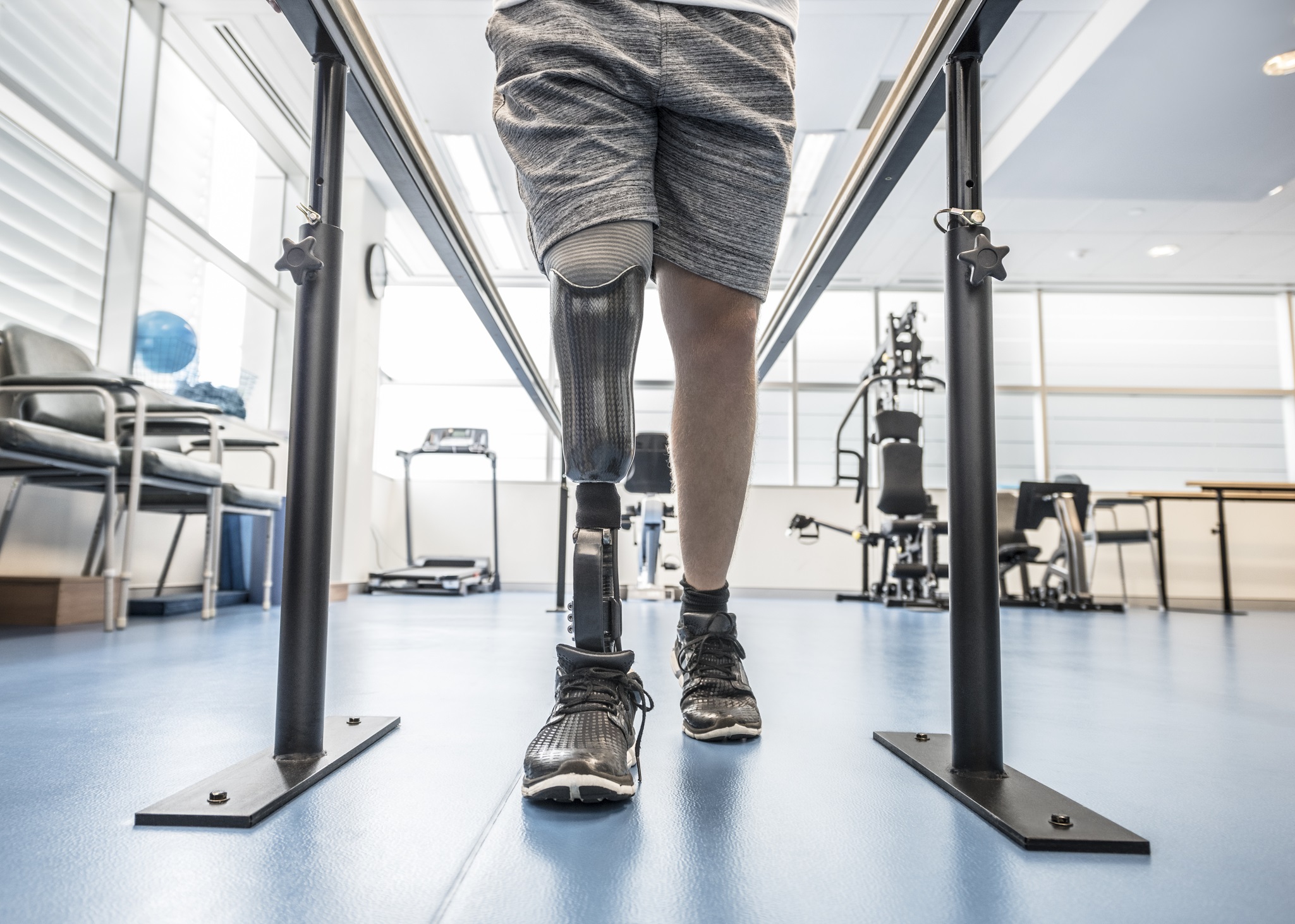 Learn To Walk With Prosthetic Leg