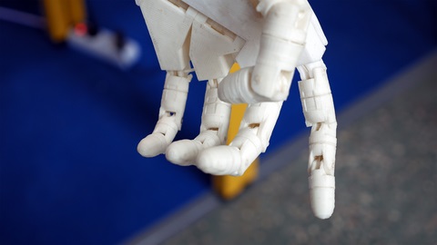 Options for Prosthetic Fingers