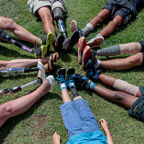 Group of amputee support group members sitting in a circle outdoors with their prosthetic legs extended toward the center, symbolizing community and support.