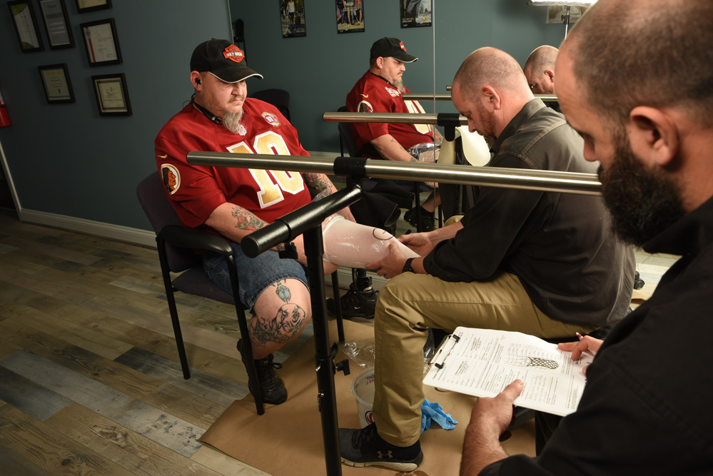 Above Knee Prosthetics Baltimore Washington